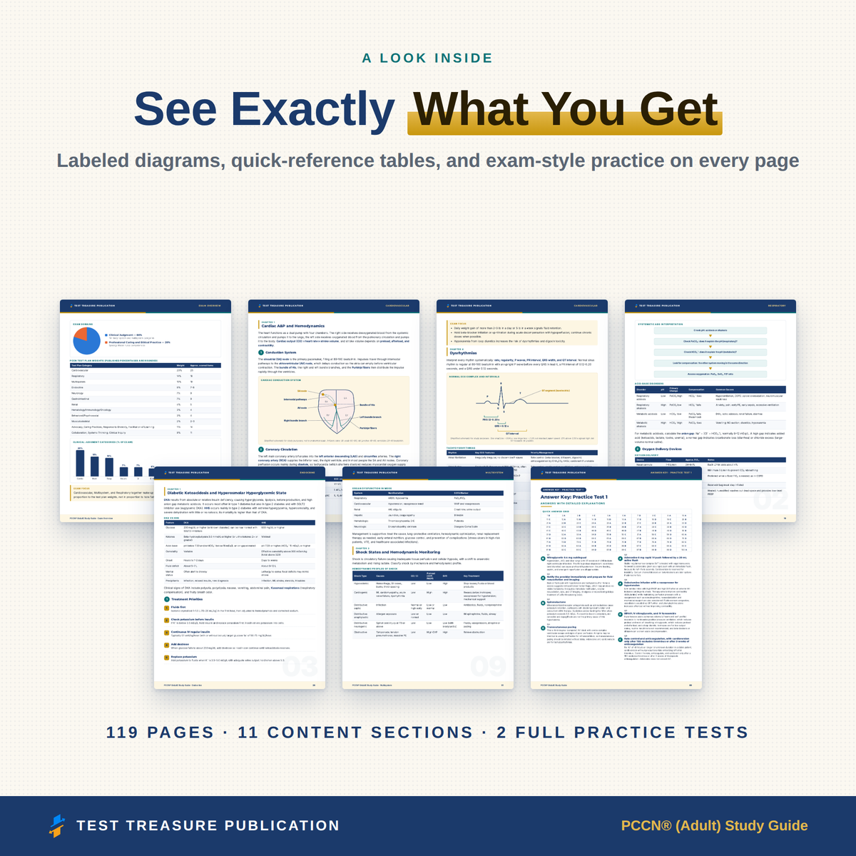 PCCN Progressive Care Nursing Study Guide 2026–2027 | 200 Practice Questions
