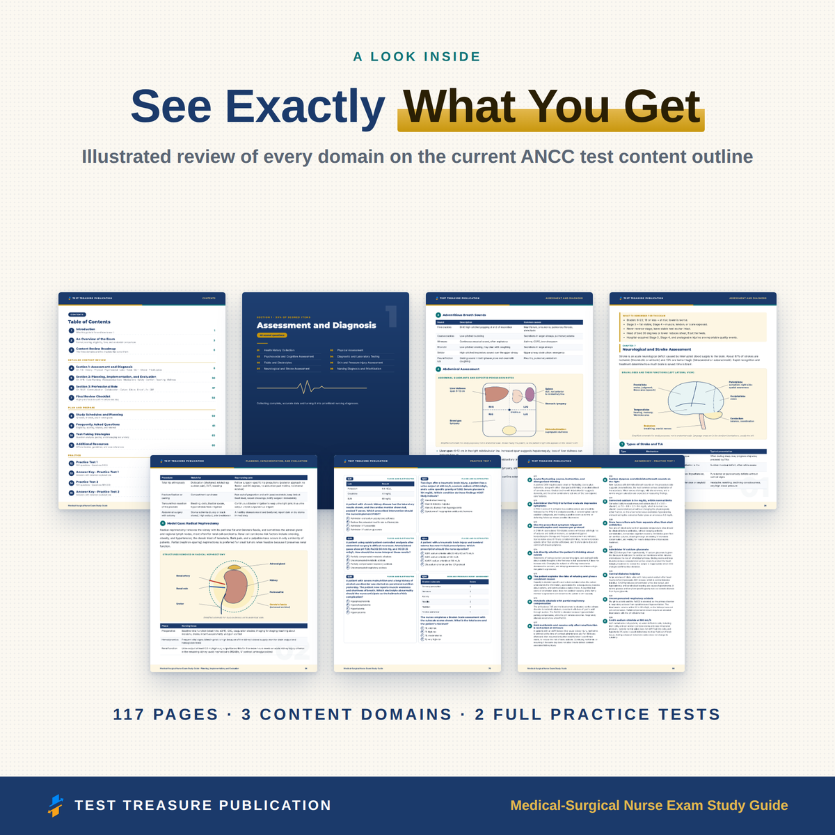Medical-Surgical Nurse Exam Study Guide 2026–2027 | 200 Practice Questions
